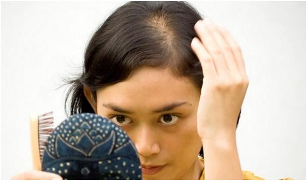 Випадання волосся у дівчаток і хлопчиків підлітків: всі причини