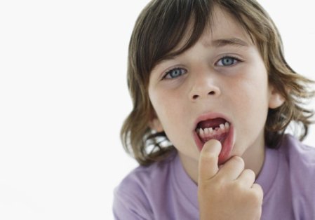 Скільки молочних зубів у дітей, випадання(зміна) зубів у малюків, лікування, догляд, фото