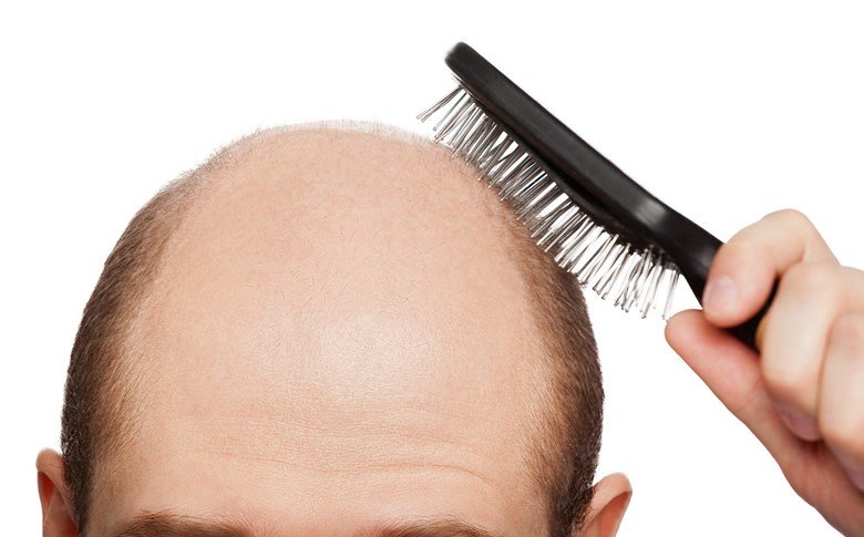 Що робити, якщо випадає волосся з білим кінчиком (цибулиною, коренем): лікування