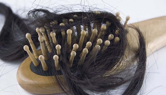 Сильне облисіння: причини випадіння волосся у жінок і чоловіків, лікування проблеми