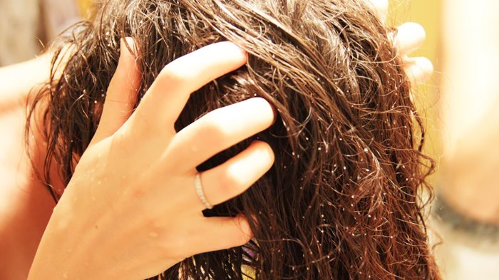 Як сіль може допомогти від випадіння волосся у жінок і чоловіків: лікування облисіння