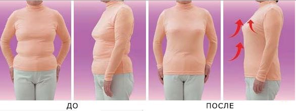 Білизна для схуднення: стягуюча, корекційний і антицеллюлитное   порівняння