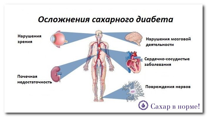Про схуднення при діабеті 2 го типу: як харчуватися при діабеті 1 го і 2 го типу