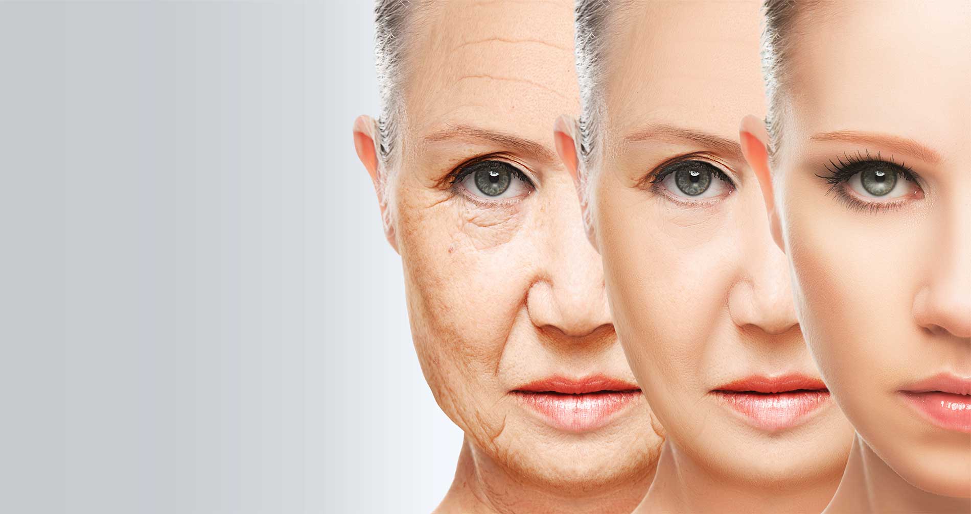 Про вікові зміни шкіри: у скільки років зявляються перші зморшки