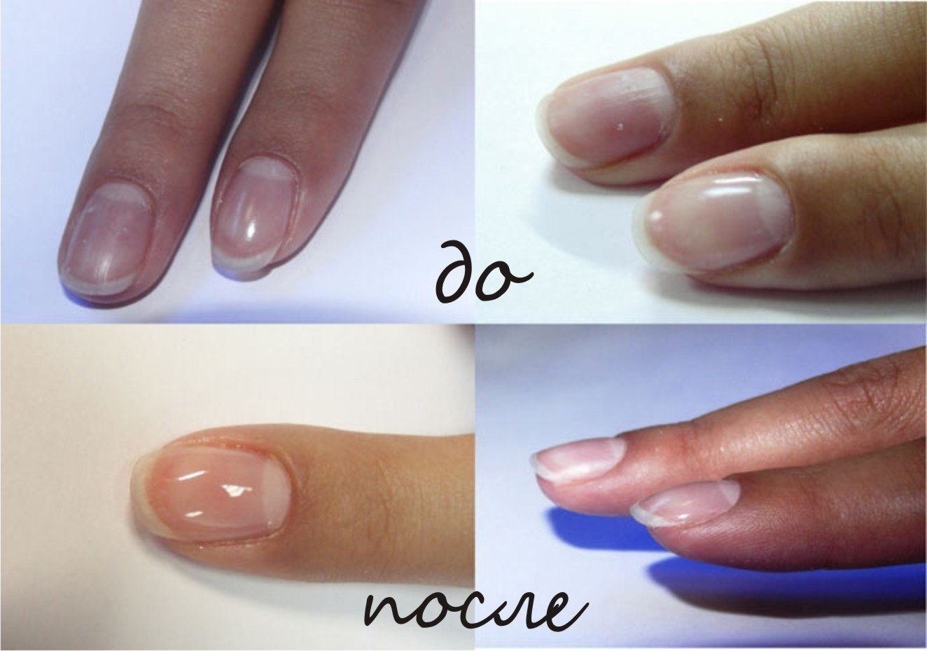 Про зміцнення нігтів гелем: як зміцнювати натуральні нігті і для нарощування