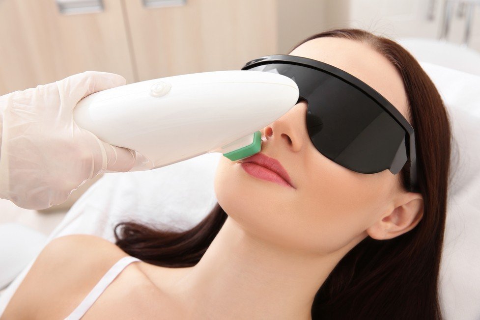 Все про лазерної епіляції верхньої губи: видалення вусів у жінок лазером