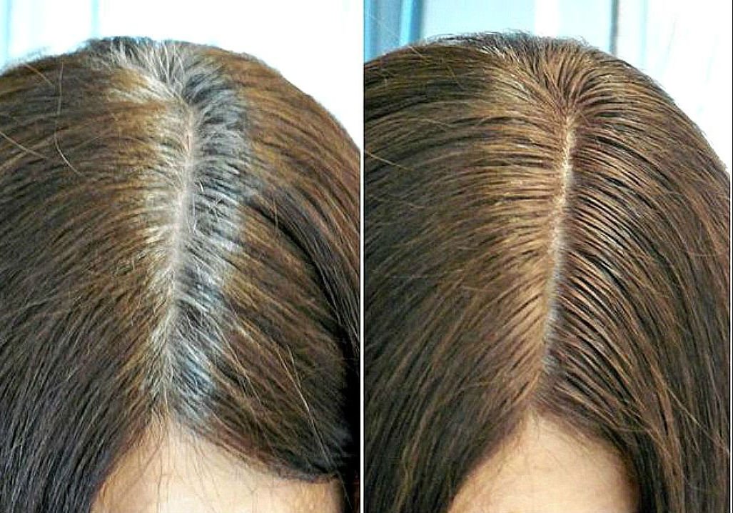 Як пофарбувати сиве волосся, щоб часто не підфарбовувати коріння кожен місяць: фото
